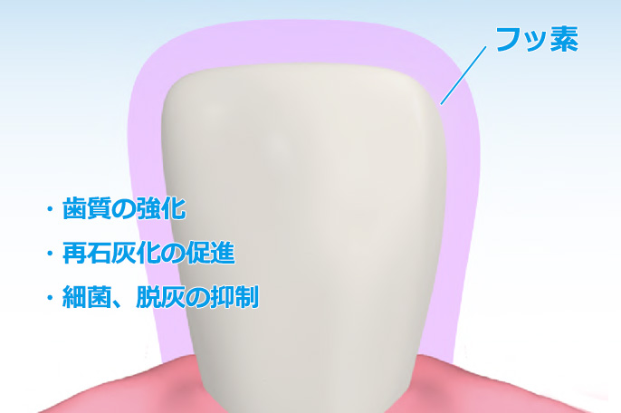 フッ素が歯質を強化する仕組みの図解